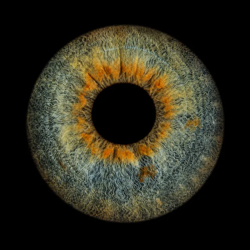 Graublaue Iris mit orangem Kranz um die Pupille, Fasern und Krypten scharf gezeichnet